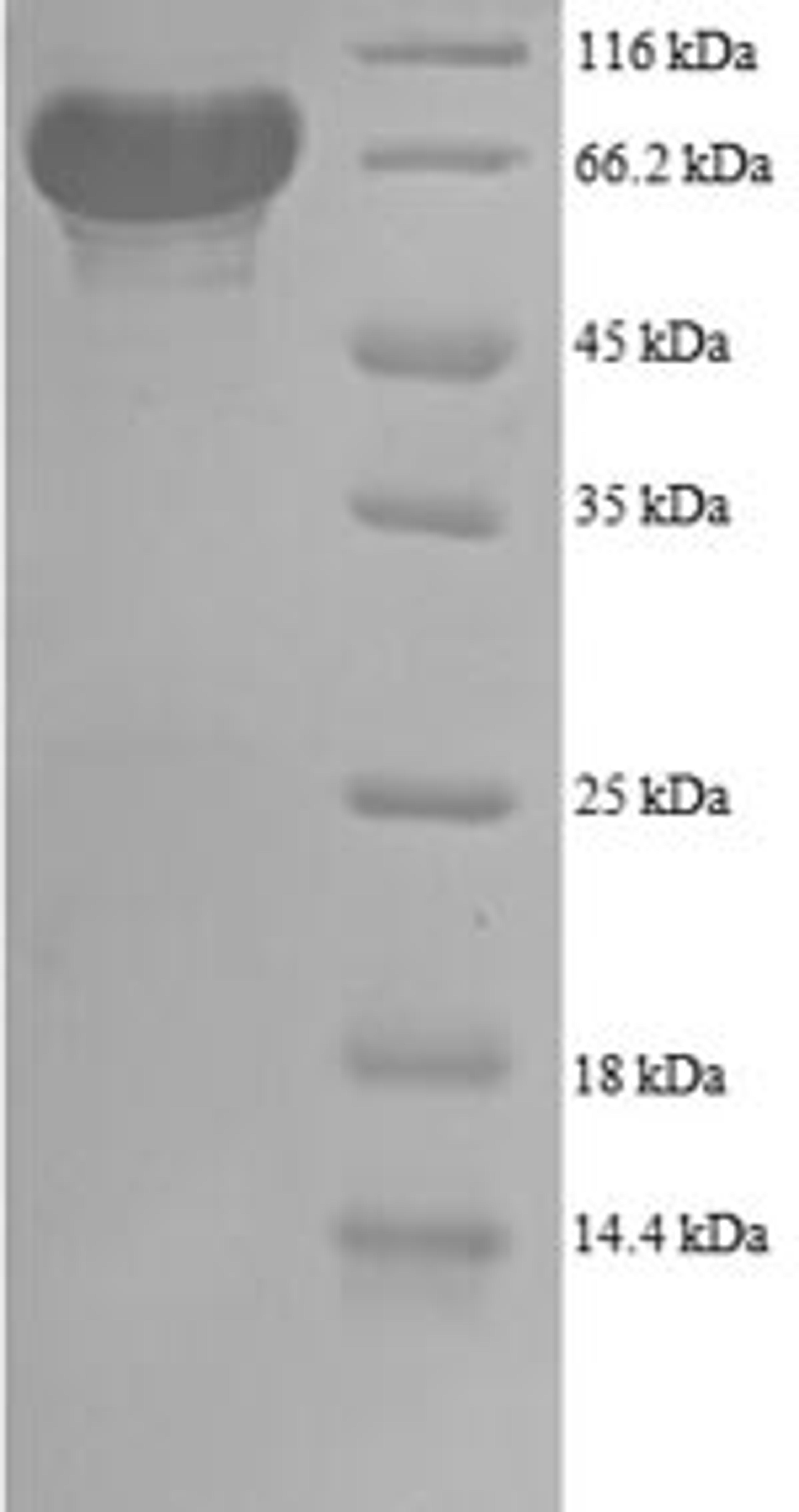 (Tris-Glycine gel) Discontinuous SDS-PAGE (reduced) with 5% enrichment gel and 15% separation gel.