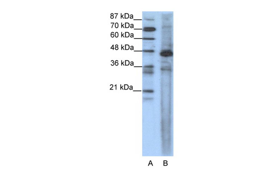 Antibody used in WB on Human Jurkat 1.25 ug/ml.