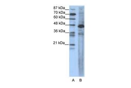 Antibody used in WB on Human Jurkat 1.25 ug/ml.