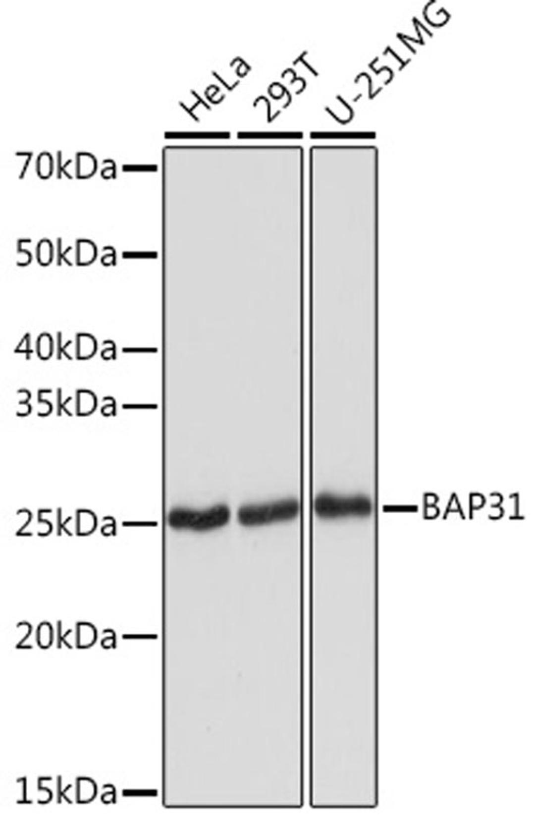 Western blot - BAP31 Rabbit mAb (A2259)