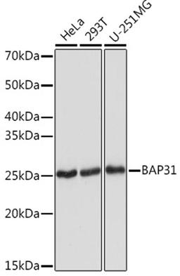 Western blot - BAP31 Rabbit mAb (A2259)