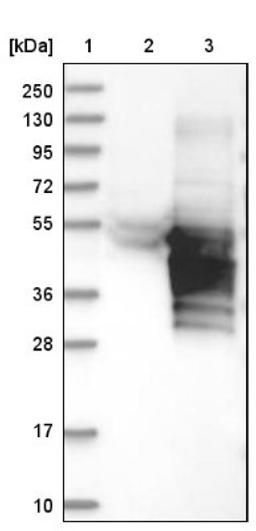 Western Blot: RHOXF2 Antibody [NBP1-84364] - Lane 1: Marker [kDa] 250, 130, 95, 72, 55, 36, 28, 17, 10<br/>Lane 2: Negative control (vector only transfected HEK293T lysate)<br/>Lane 3: Over-expression lysate (Co-expressed with a C-terminal myc-DDK tag (~3.1 kDa) in mammalian HEK293T cells, LY410076)