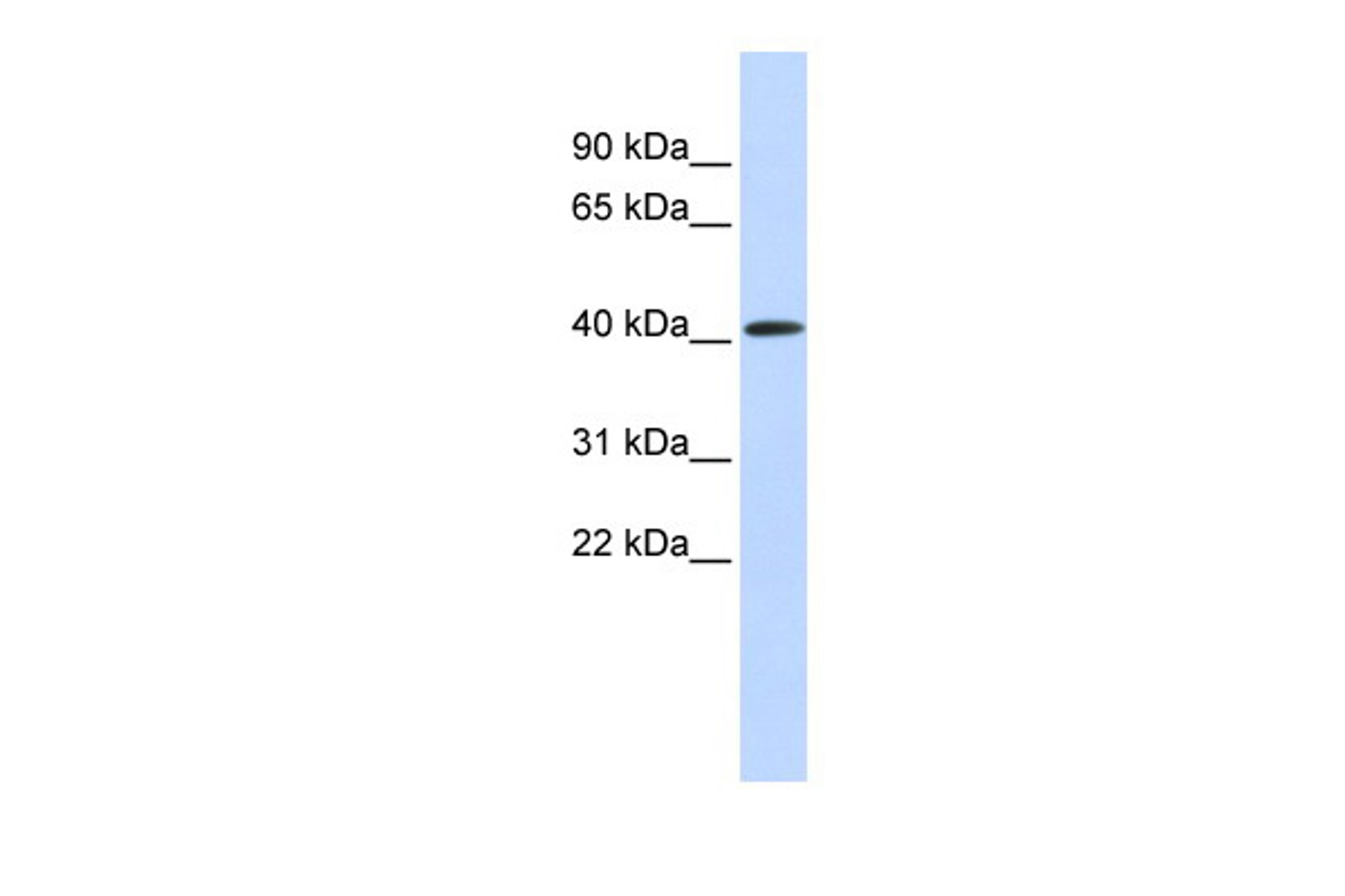 Antibody used in WB on Human Muscle at 0.2-1 ug/ml.