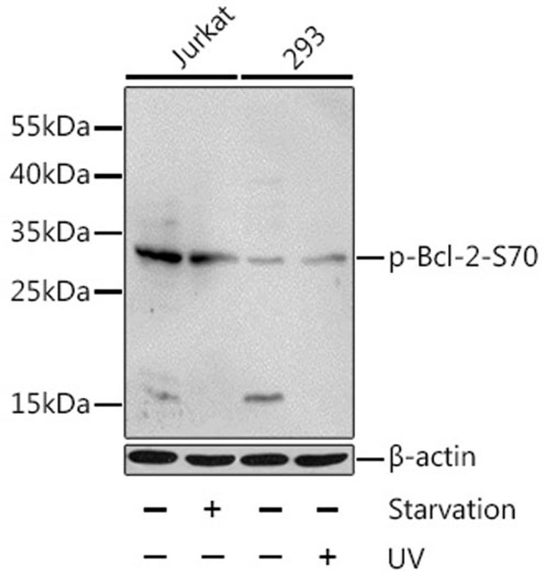 Western blot - Phospho-Bcl2 -S70 antibody (AP0575)