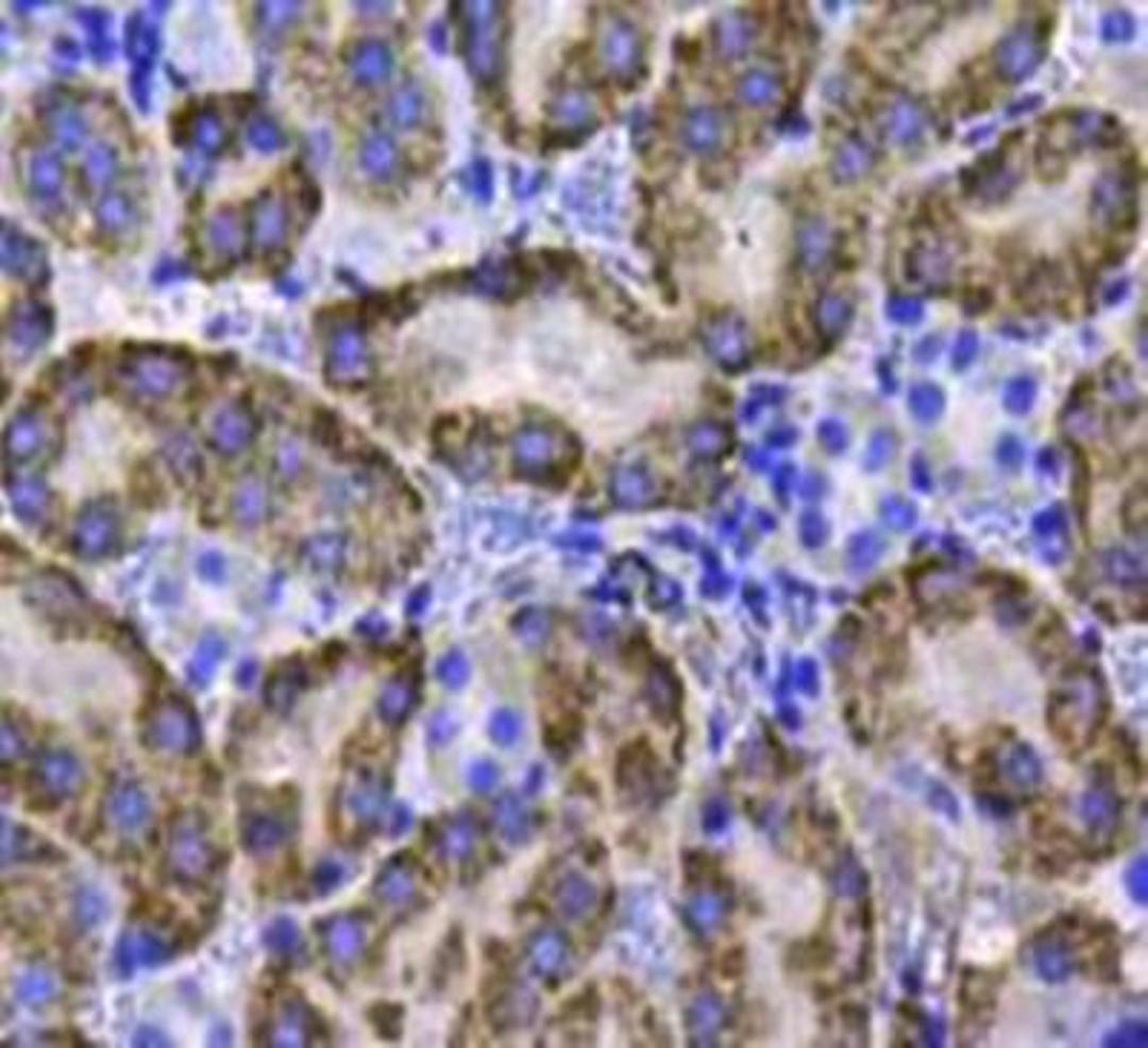 Immunohistochemical staining of mouse kidney tissue using Catalase antibody