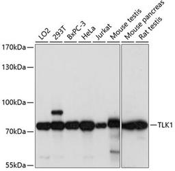 Western blot - TLK1 antibody (A14831)