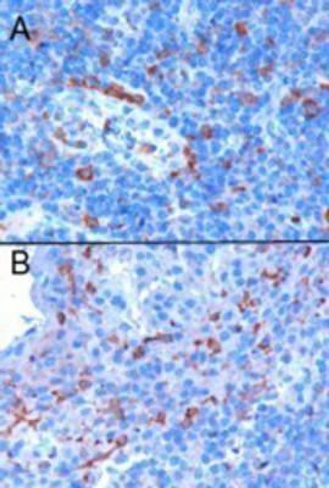 Immunohistochemistry-Paraffin: EFHD2 Antibody [NB100-1477] - Analysis of human tonsil. Microwaved antigen retrieval with citrate buffer pH6, HRP-staining. Positive cells A) in the interfollicular area and surrounding a vessel, B) in proximity of the epithelial criptae.