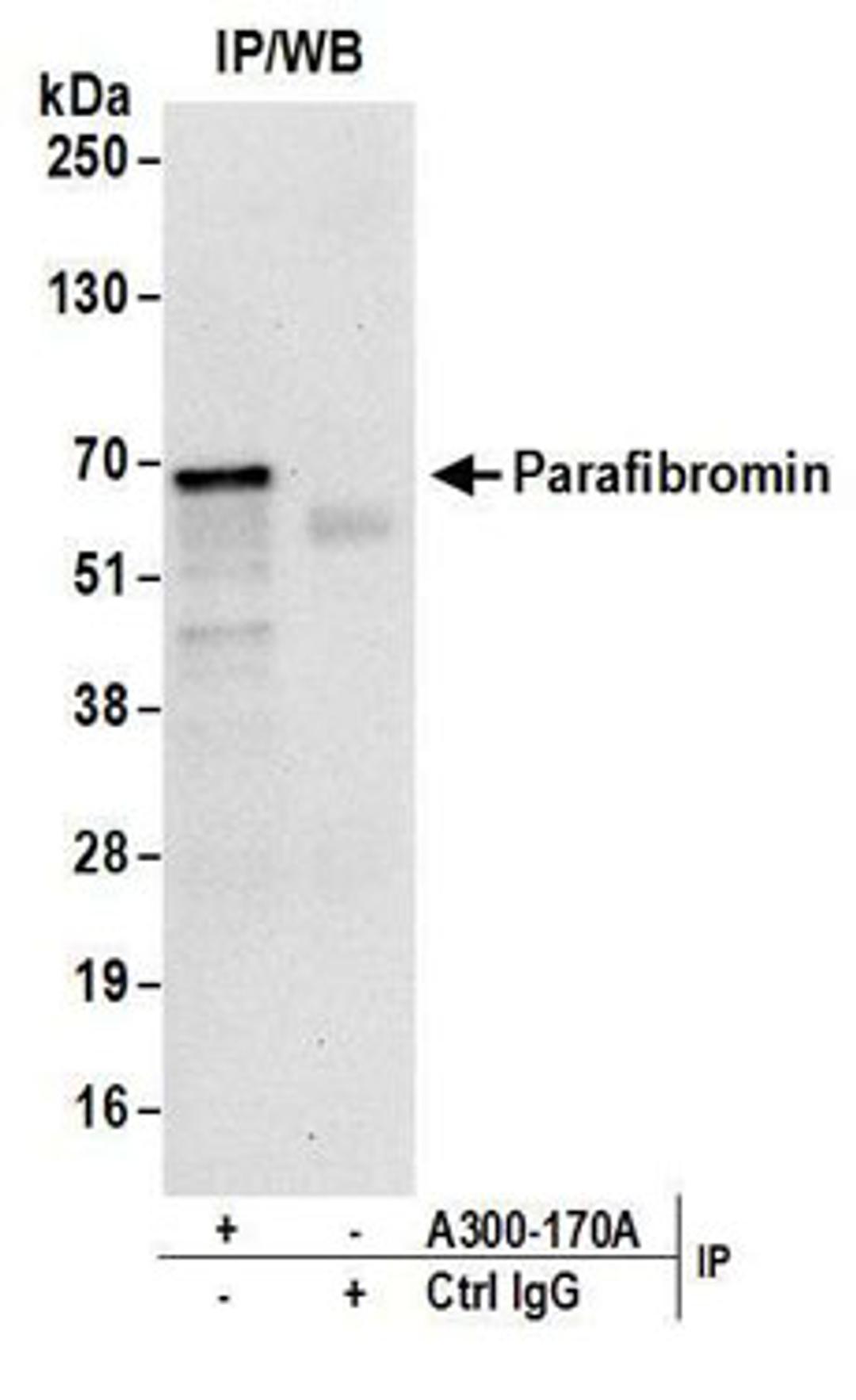 Detection of human Parafibromin by western blot of immunoprecipitates.