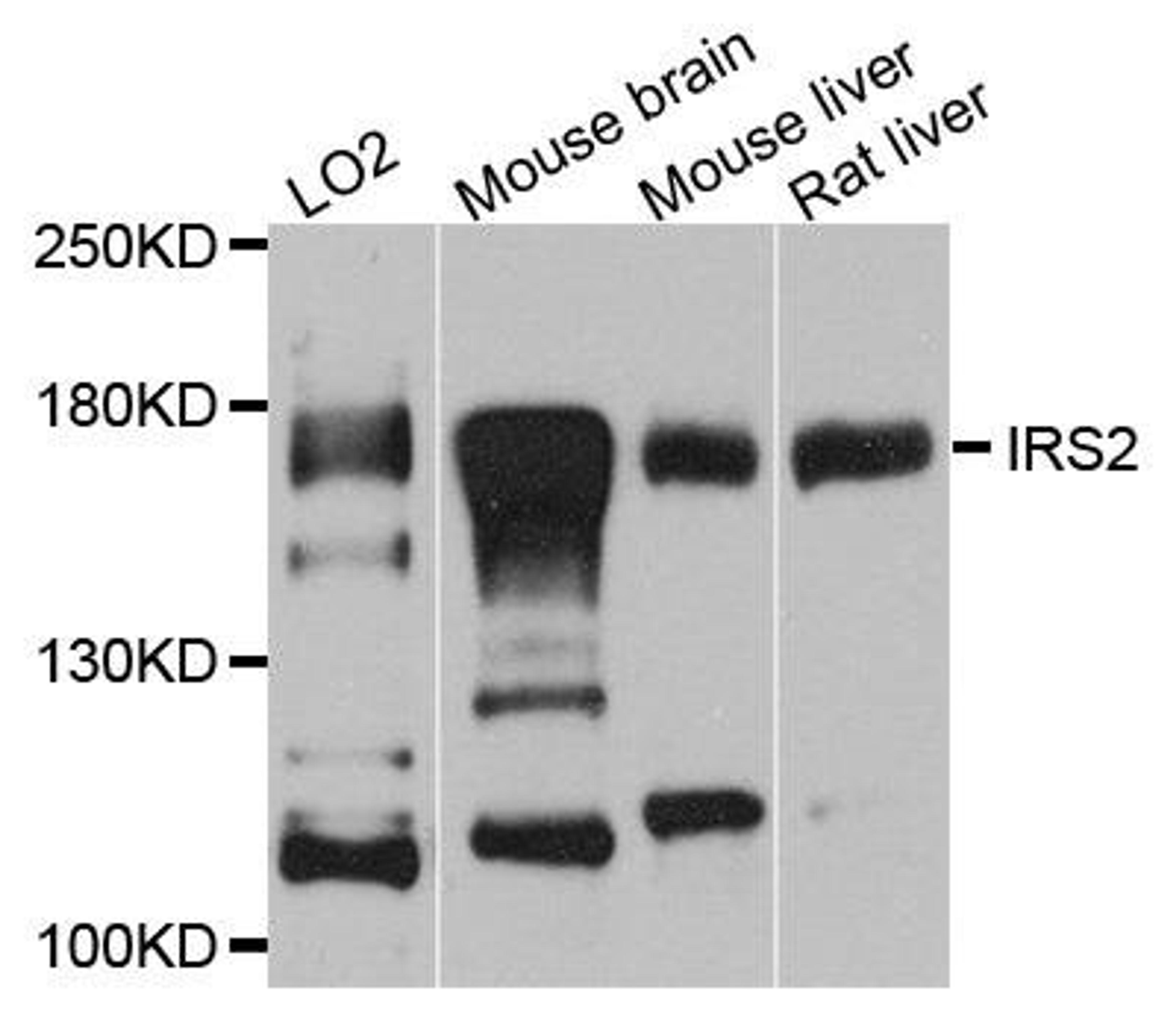 Western blot analysis of extracts of various cells using IRS2 antibody