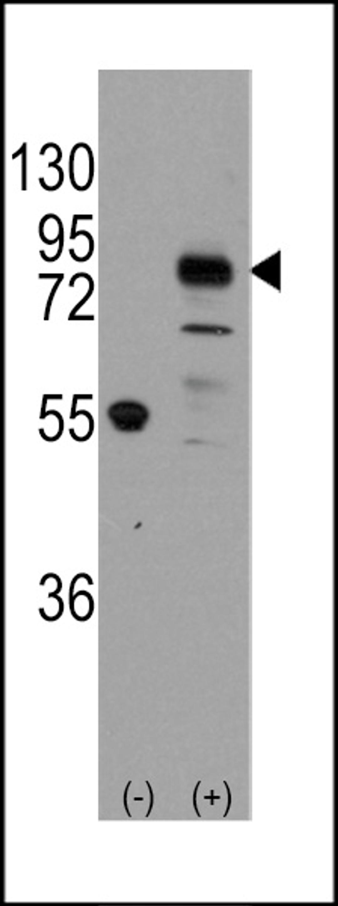 Western blot analysis of CDH9 using rabbit polyclonal CDH9 Antibody using 293 cell lysates (2 ug/lane) either nontransfected (Lane 1) or transiently transfected with the CDH9 gene (Lane 2).