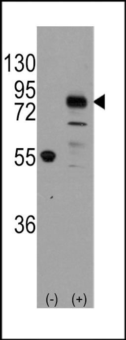 Western blot analysis of CDH9 using rabbit polyclonal CDH9 Antibody using 293 cell lysates (2 ug/lane) either nontransfected (Lane 1) or transiently transfected with the CDH9 gene (Lane 2).