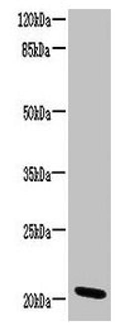 Western blot. All lanes: CCDC32 antibody at 2ug/ml + HL60 whole cell lysate. Secondary. Goat polyclonal to rabbit IgG at 1/10000 dilution. Predicted band size: 21, 22, 16 kDa. Observed band size: 21 kDa.