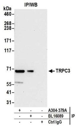 Detection of human TRPC3 by western blot of immunoprecipitates.