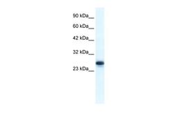 Antibody used in WB on Human Jurkat cells at 1.25 ug/ml.