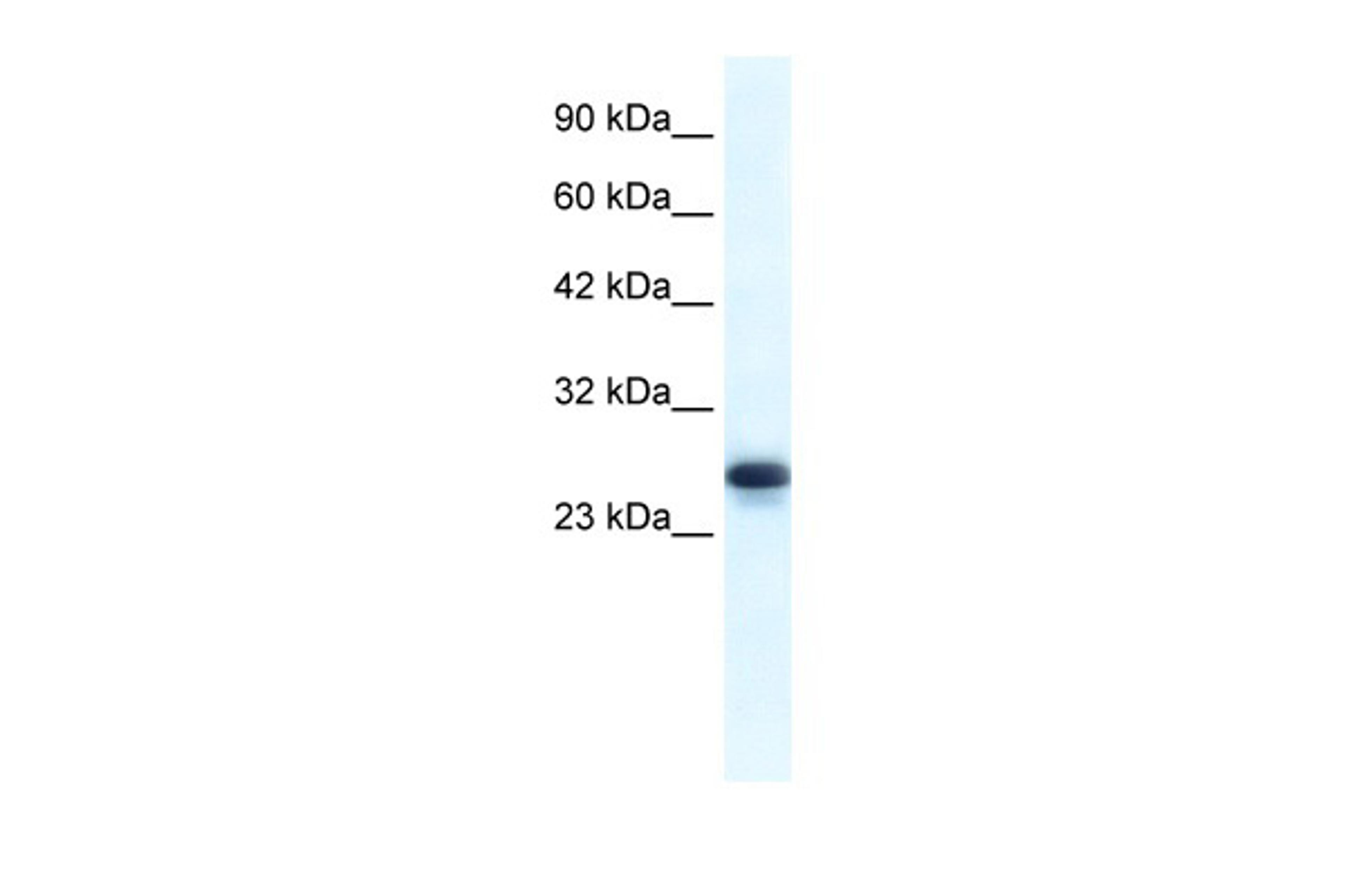 Antibody used in WB on Human Jurkat cells at 1.25 ug/ml.