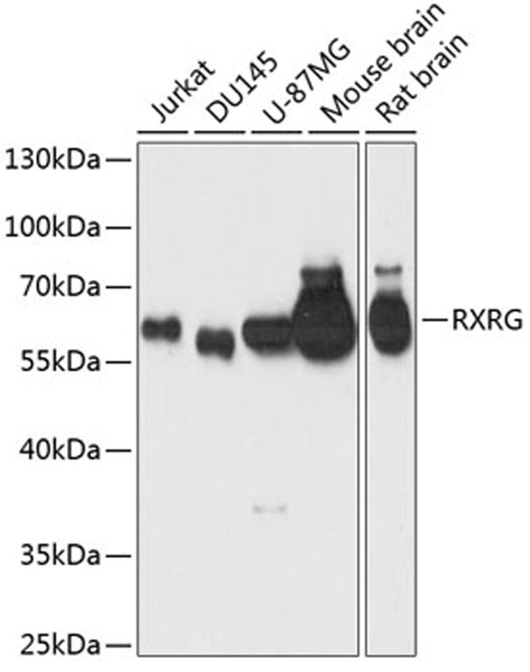 Western blot - RXRG antibody (A1877)