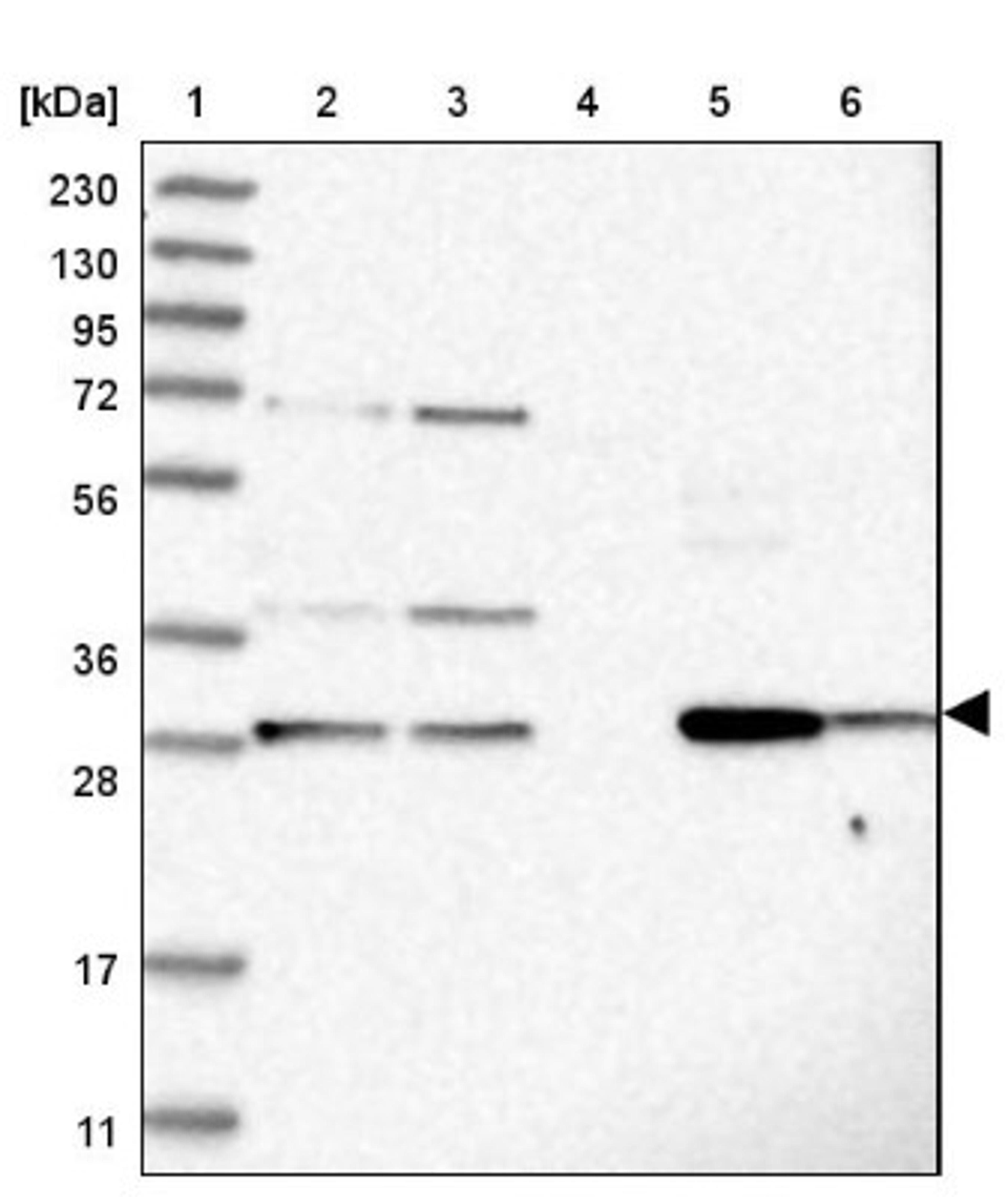 Western Blot: PPAP2B Antibody [NBP1-82825] - Lane 1: Marker [kDa] 230, 130, 95, 72, 56, 36, 28, 17, 11<br/>Lane 2: Human cell line RT-4<br/>Lane 3: Human cell line U-251MG sp<br/>Lane 4: Human plasma (IgG/HSA depleted)<br/>Lane 5: Human liver tissue<br/>Lane 6: Human tonsil tissue