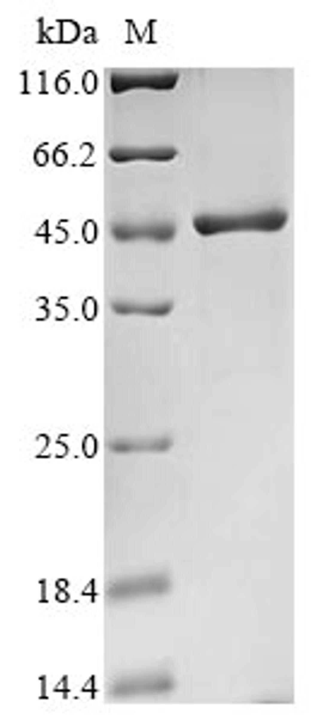 (Tris-Glycine gel) Discontinuous SDS-PAGE (reduced) with 5% enrichment gel and 15% separation gel.