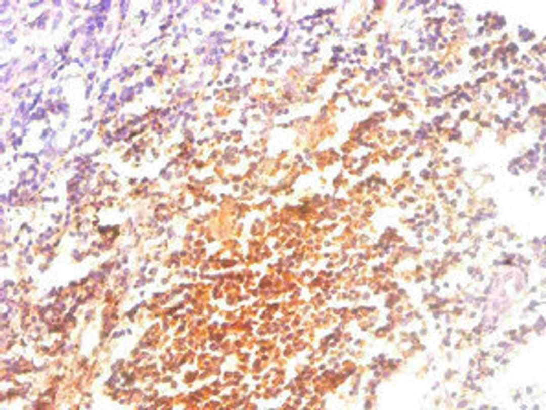 Immunohistochemical of paraffin-embedded human Tonsil tissue using CSB-MA057861A0m at dilution of 1:200