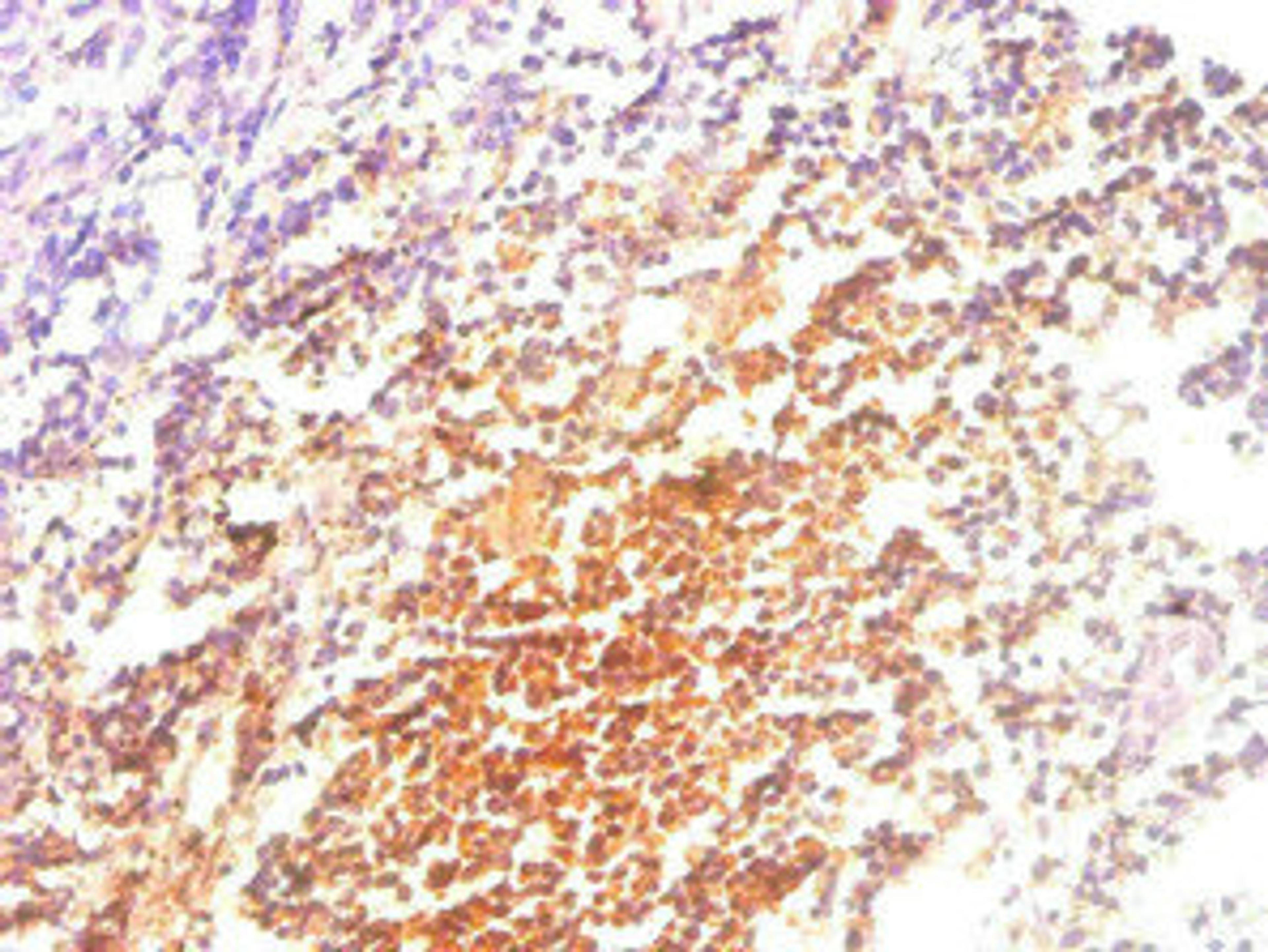 Immunohistochemical of paraffin-embedded human Tonsil tissue using CSB-MA057861A0m at dilution of 1:200