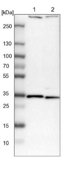 Western Blot: DENR Antibody [NBP2-13913] - Lane 1: NIH-3T3 cell lysate (Mouse embryonic fibroblast cells)<br/>Lane 2: NBT-II cell lysate (Rat Wistar bladder tumour cells)