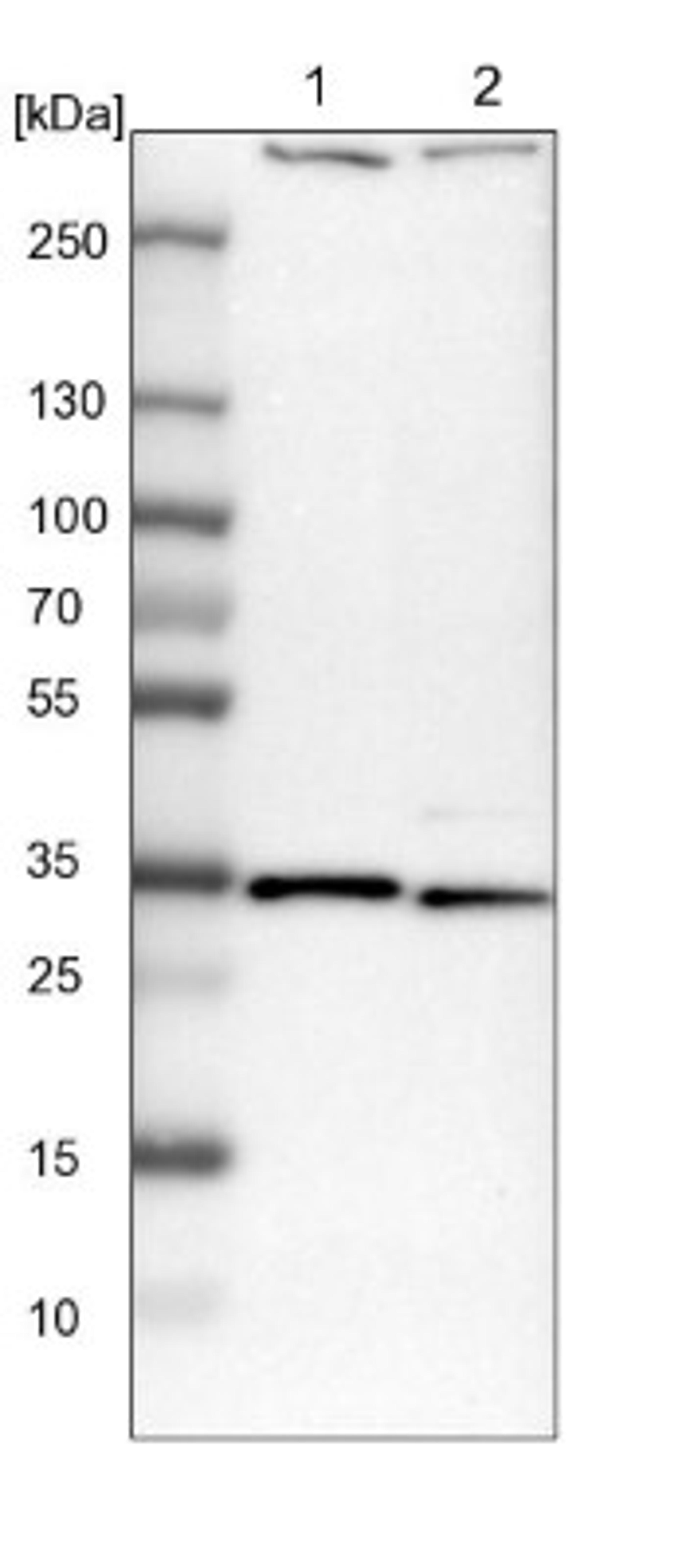 Western Blot: DENR Antibody [NBP2-13913] - Lane 1: NIH-3T3 cell lysate (Mouse embryonic fibroblast cells)<br/>Lane 2: NBT-II cell lysate (Rat Wistar bladder tumour cells)