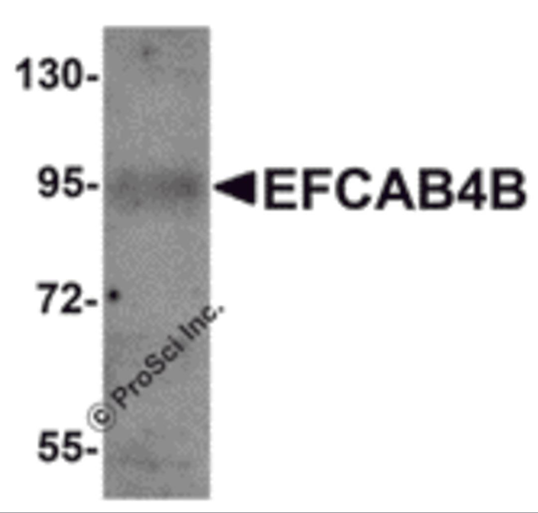 Western blot analysis of EFCAB4B in mouse kidney tissue lysate with EFCAB4B antibody at 1 μg/mL.