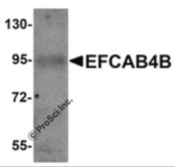 Western blot analysis of EFCAB4B in mouse kidney tissue lysate with EFCAB4B antibody at 1 μg/mL.