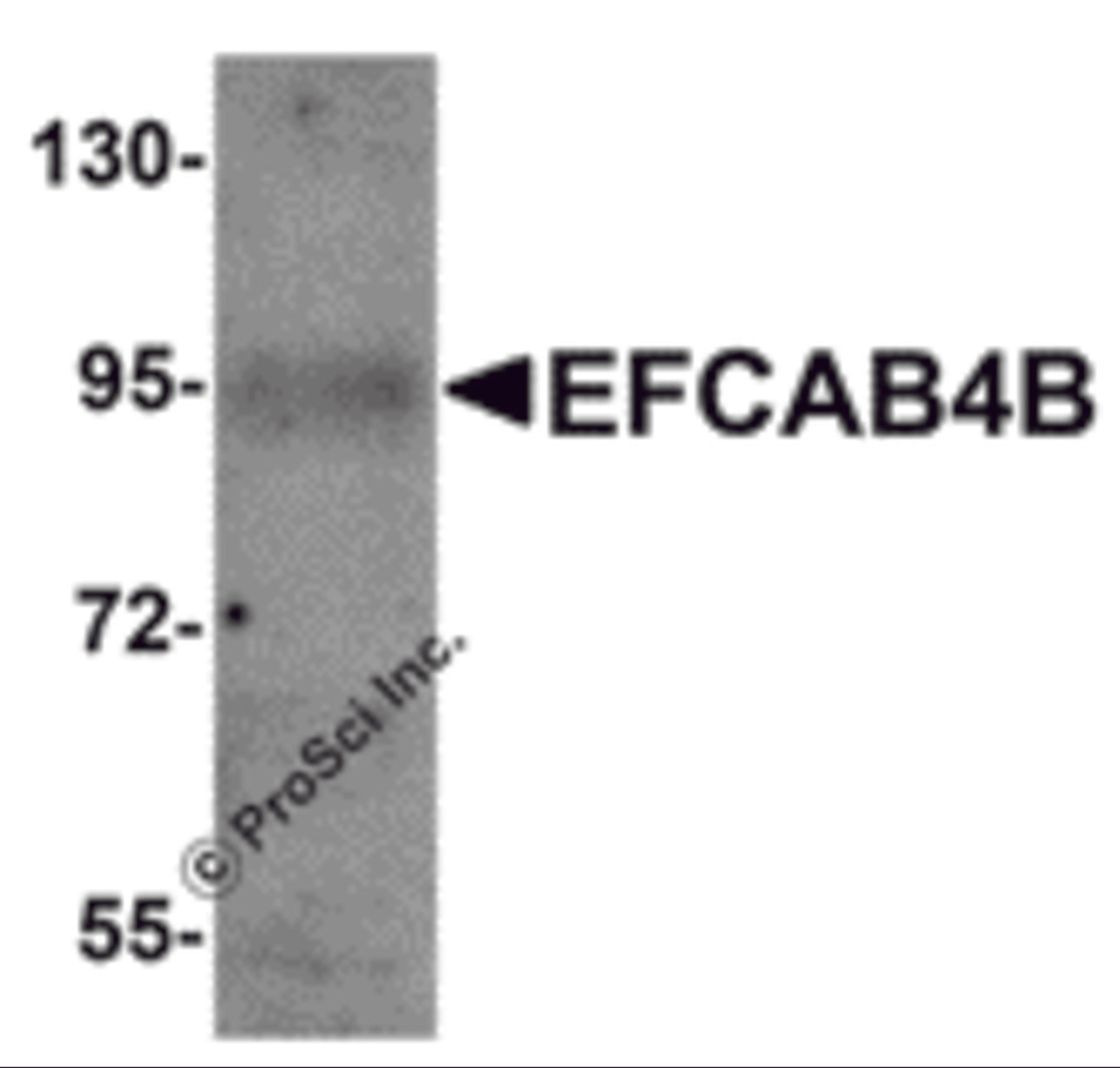 Western blot analysis of EFCAB4B in mouse kidney tissue lysate with EFCAB4B antibody at 1 μg/mL.