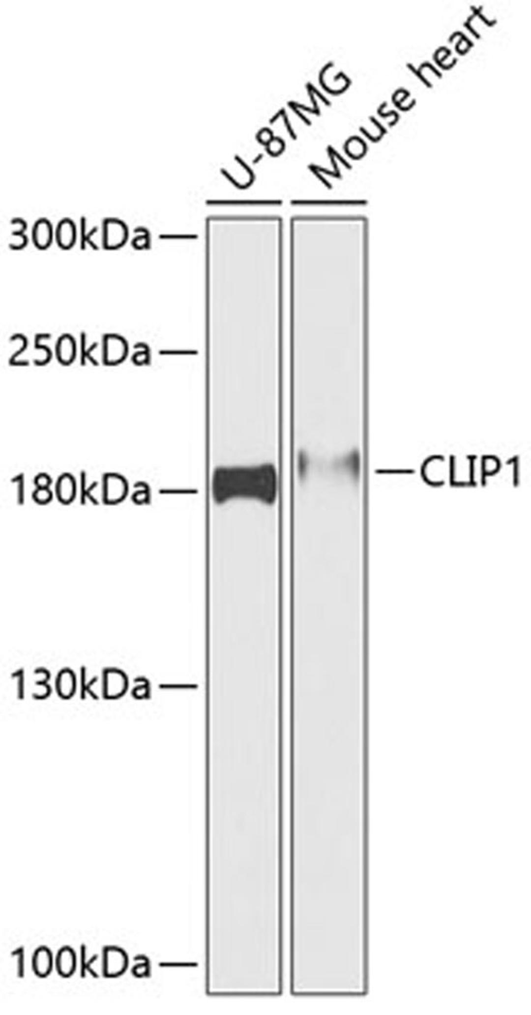 Western blot - CLIP1 antibody (A12498)