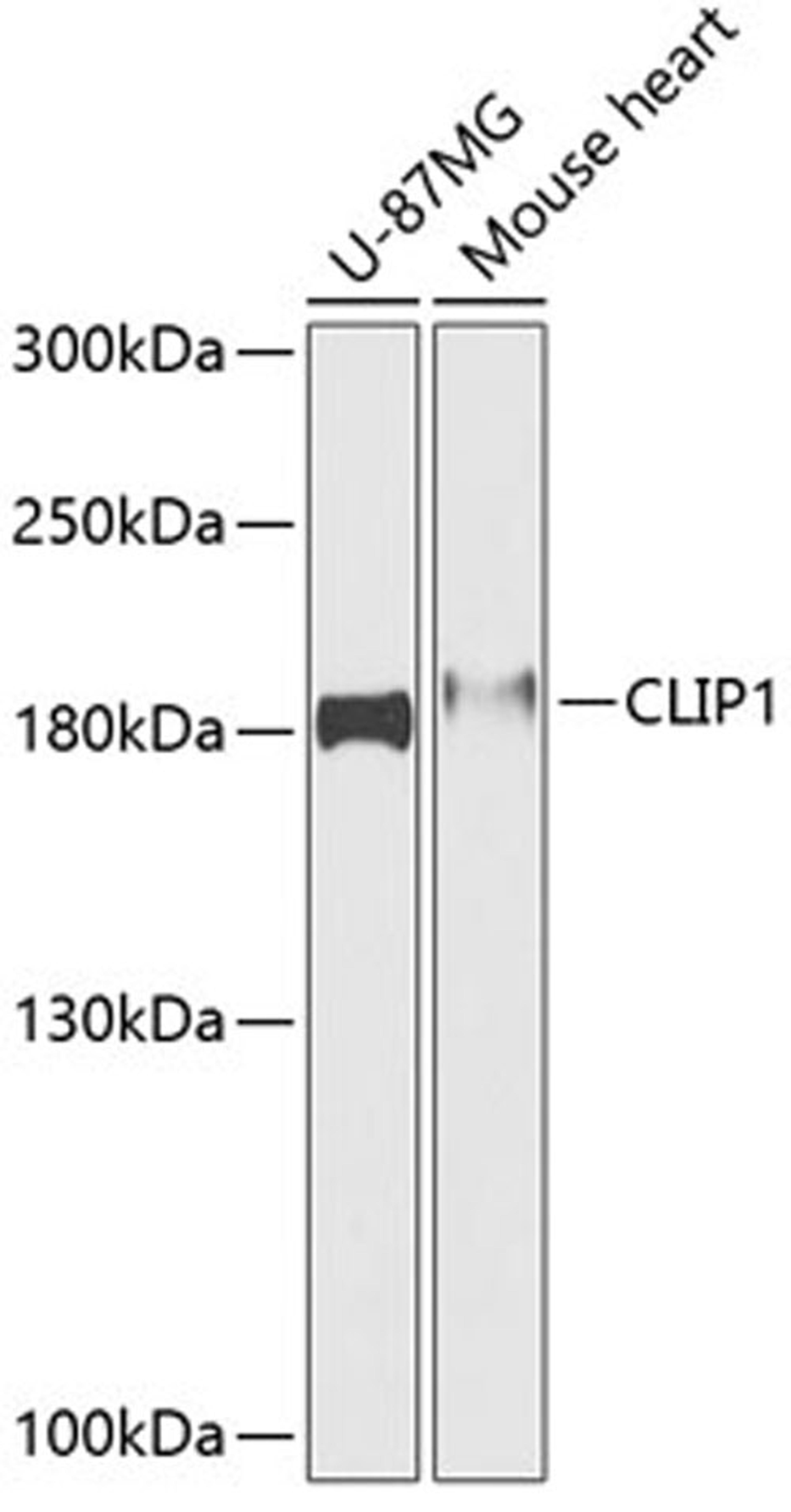 Western blot - CLIP1 antibody (A12498)