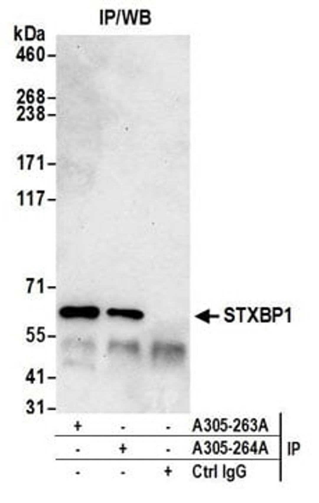 Detection of human STXBP1 by western blot of immunoprecipitates.