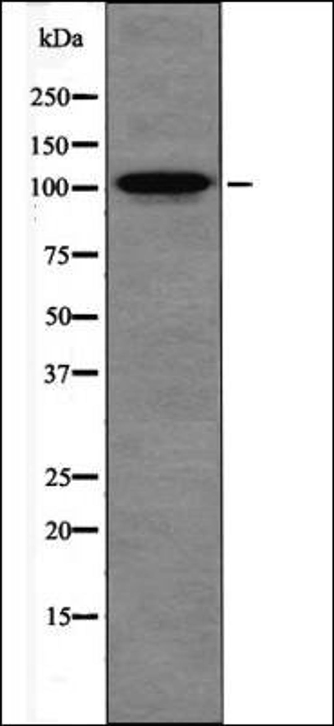 Western blot analysis of HepG2 whole cell lysates using DNA Ligase 4 -Phospho-Thr650- antibody