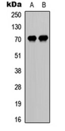 Western blot analysis of HeLa UV-treated (Lane 1), mouse liver (Lane 2) whole cell lysates using CDC25A (phospho-S75) antibody