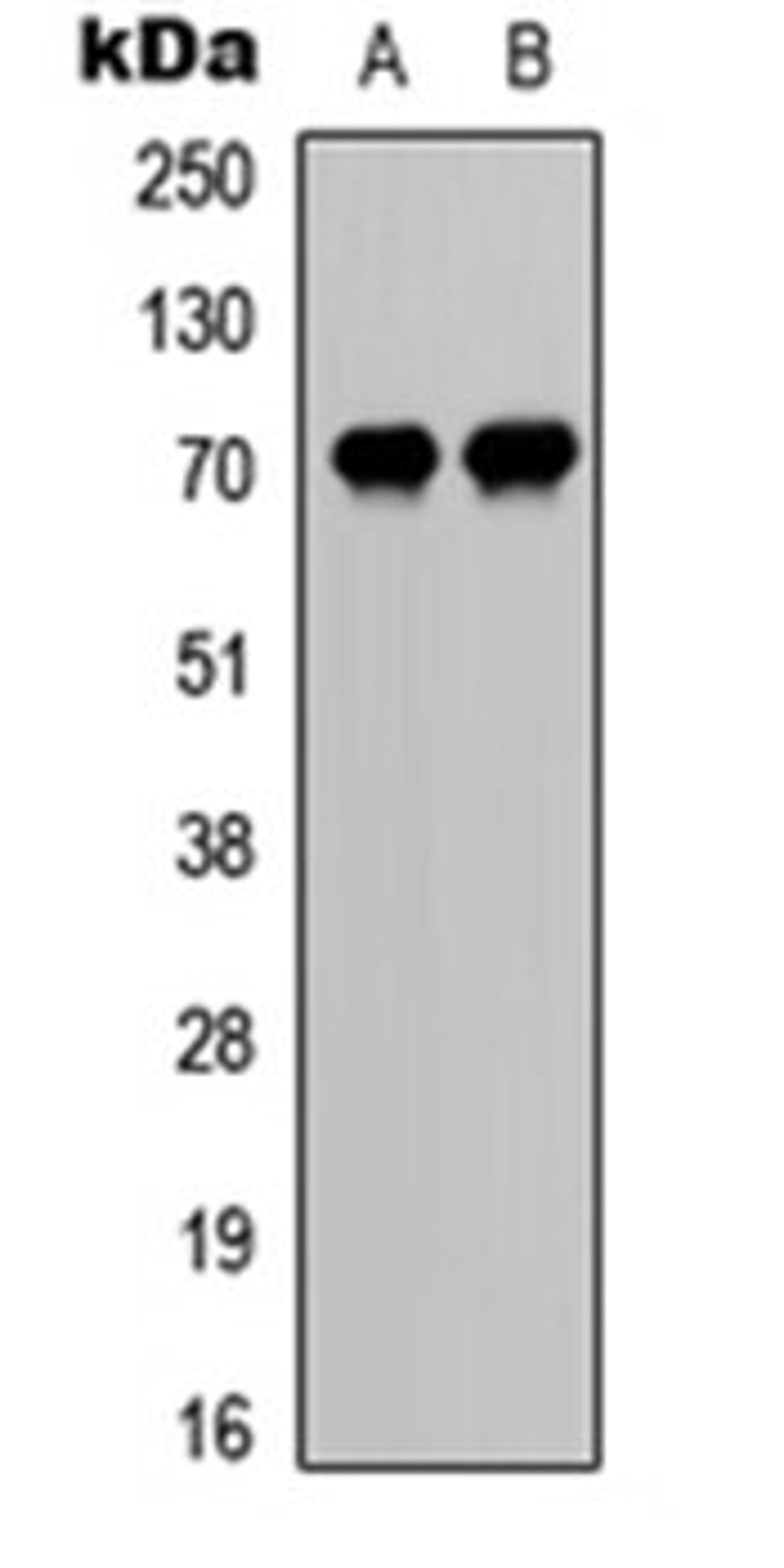 Western blot analysis of HeLa UV-treated (Lane 1), mouse liver (Lane 2) whole cell lysates using CDC25A (phospho-S75) antibody