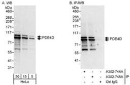 Detection of human PDE4D by western blot and immunoprecipitation.