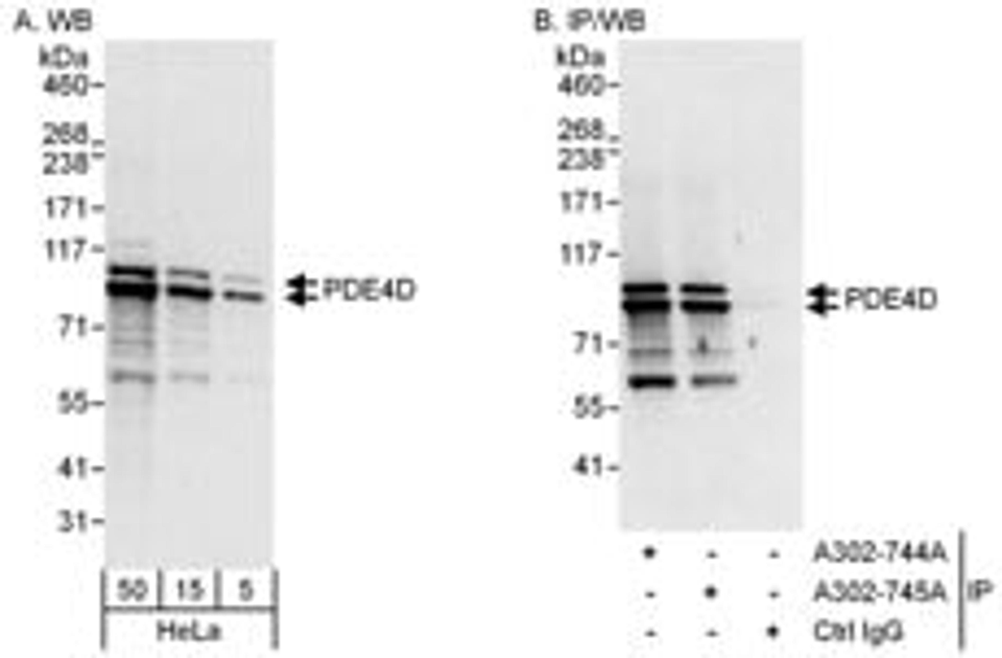 Detection of human PDE4D by western blot and immunoprecipitation.