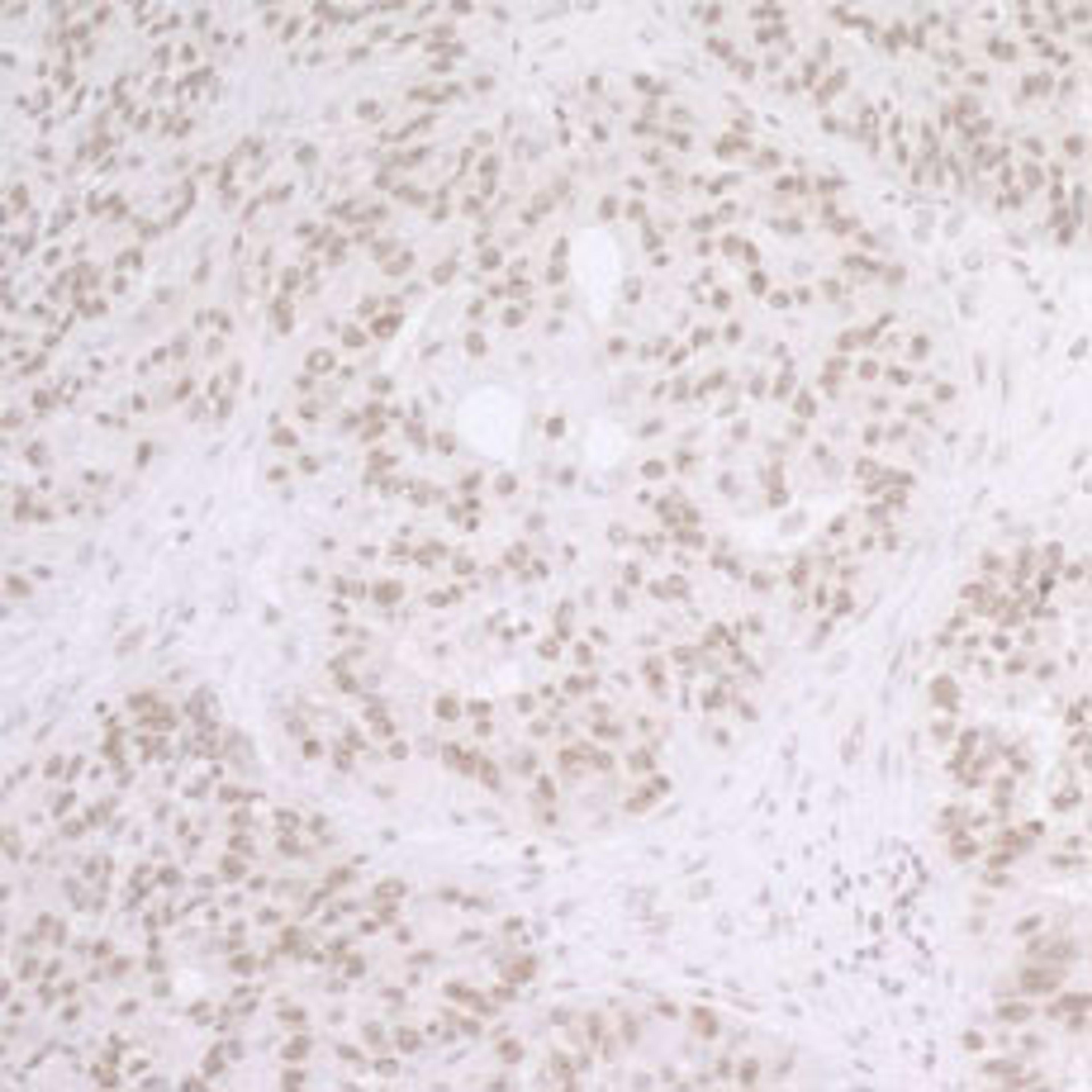 Detection of human SET by immunohistochemistry.