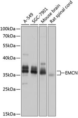 Western blot - EMCN antibody (A14131)