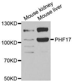 Western blot analysis of extracts of various cell lines using PHF17 antibody