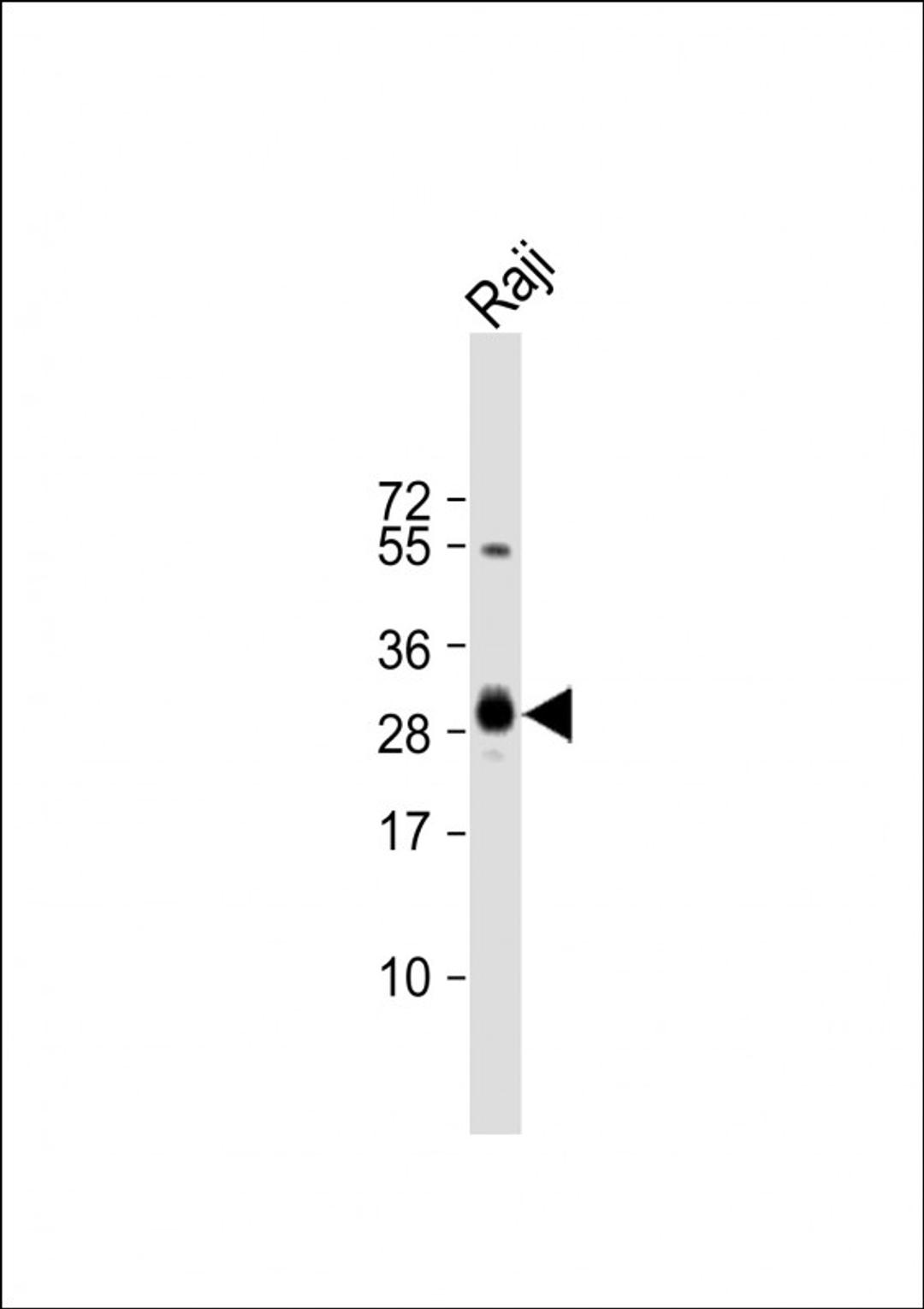 Western Blot at 1:4000 dilution + Raji whole cell lysate Lysates/proteins at 20 ug per lane.