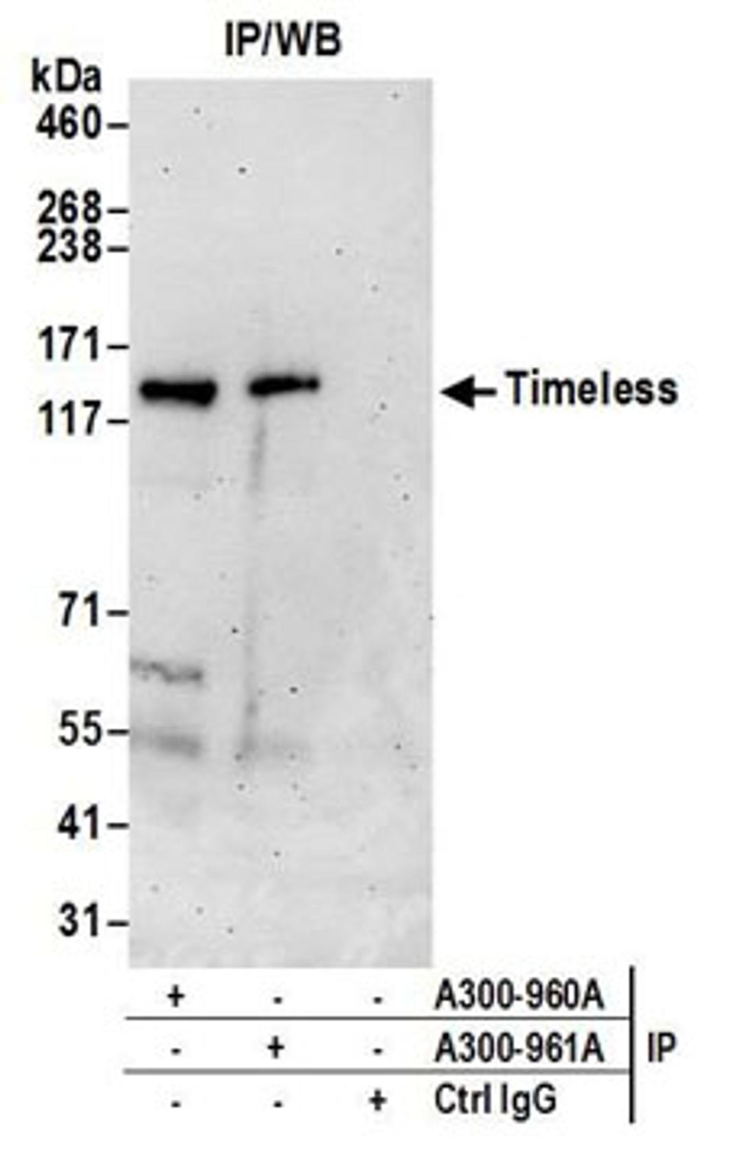 Detection of human Timeless by western blot of immunoprecipitates.