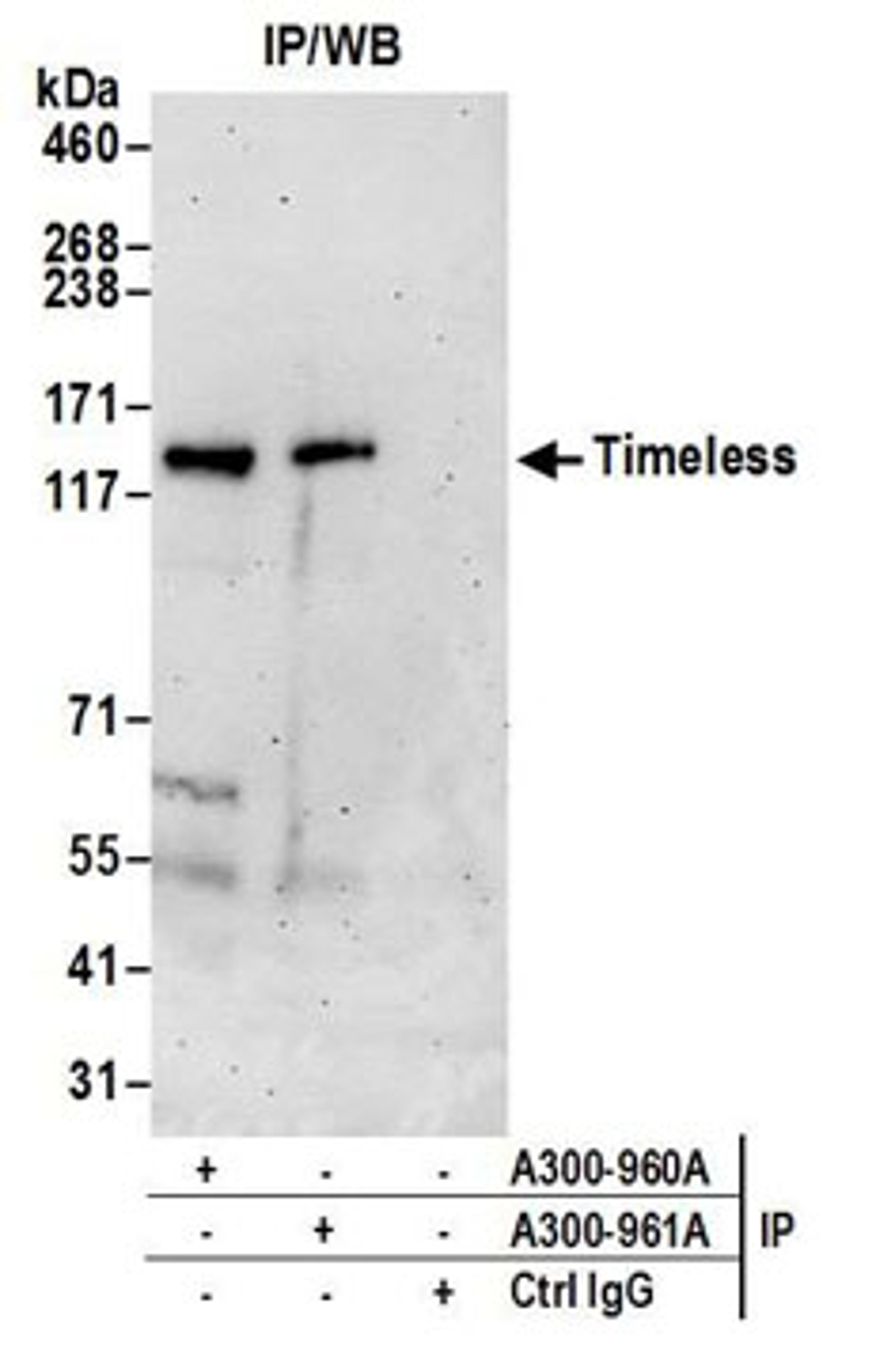 Detection of human Timeless by western blot of immunoprecipitates.