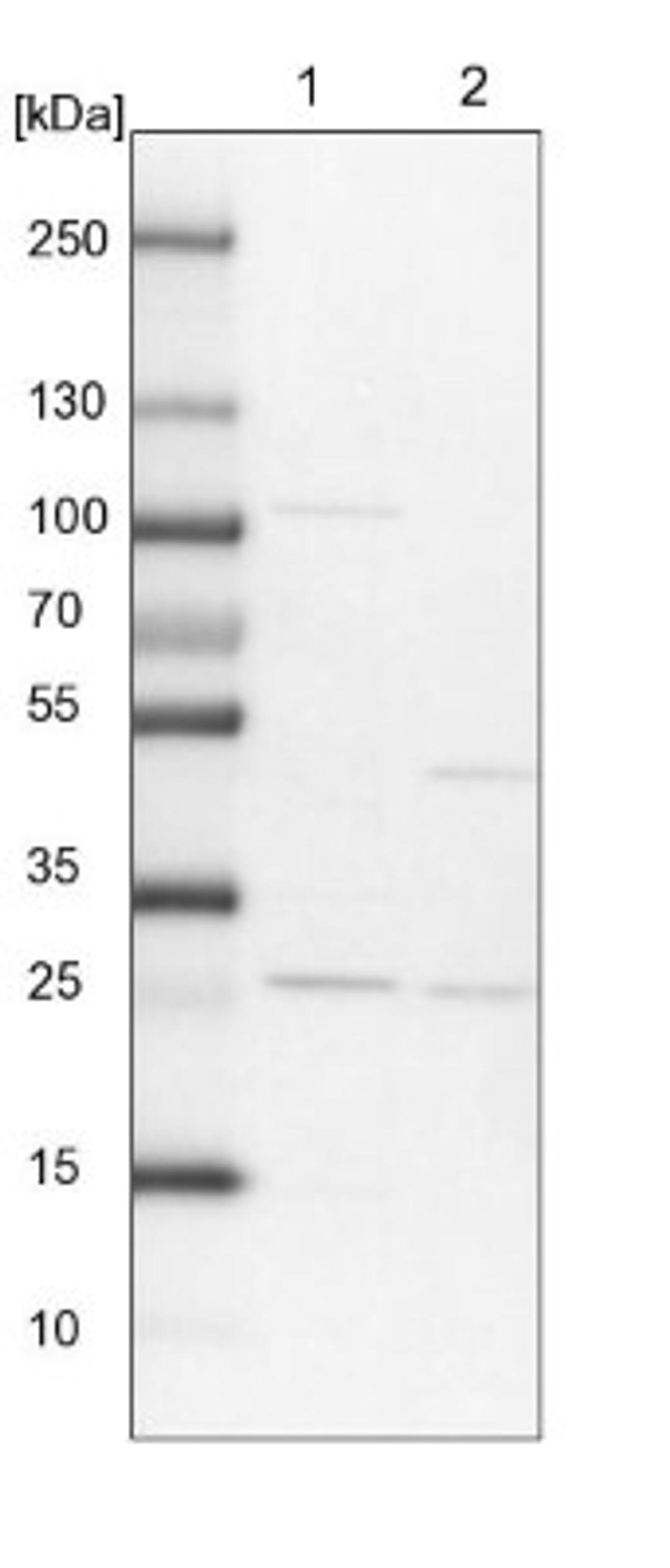 Western Blot: RERGL Antibody [NBP1-82115] - Lane 1: NIH-3T3 cell lysate (Mouse embryonic fibroblast cells)<br/>Lane 2: NBT-II cell lysate (Rat Wistar bladder tumour cells)