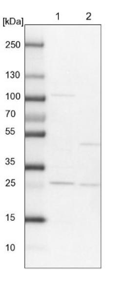 Western Blot: RERGL Antibody [NBP1-82115] - Lane 1: NIH-3T3 cell lysate (Mouse embryonic fibroblast cells)<br/>Lane 2: NBT-II cell lysate (Rat Wistar bladder tumour cells)