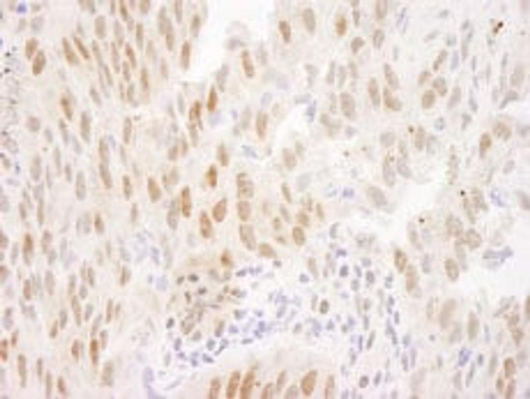 Detection of human FOXO3a by immunohistochemistry.