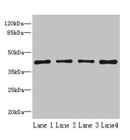 Western blot. All lanes: S1PR1 antibody at 2µg/ml. Lane 1: Jurkat whole cell lysate. Lane 2: A375 whole cell lysate. Lane 3: Mouse thymus tissue. Lane 4: HepG2 whole cell lysate. Secondary. Goat polyclonal to rabbit IgG at 1/10000 dilution. Predicted band size: 43 kDa. Observed band size: 43 kDa
