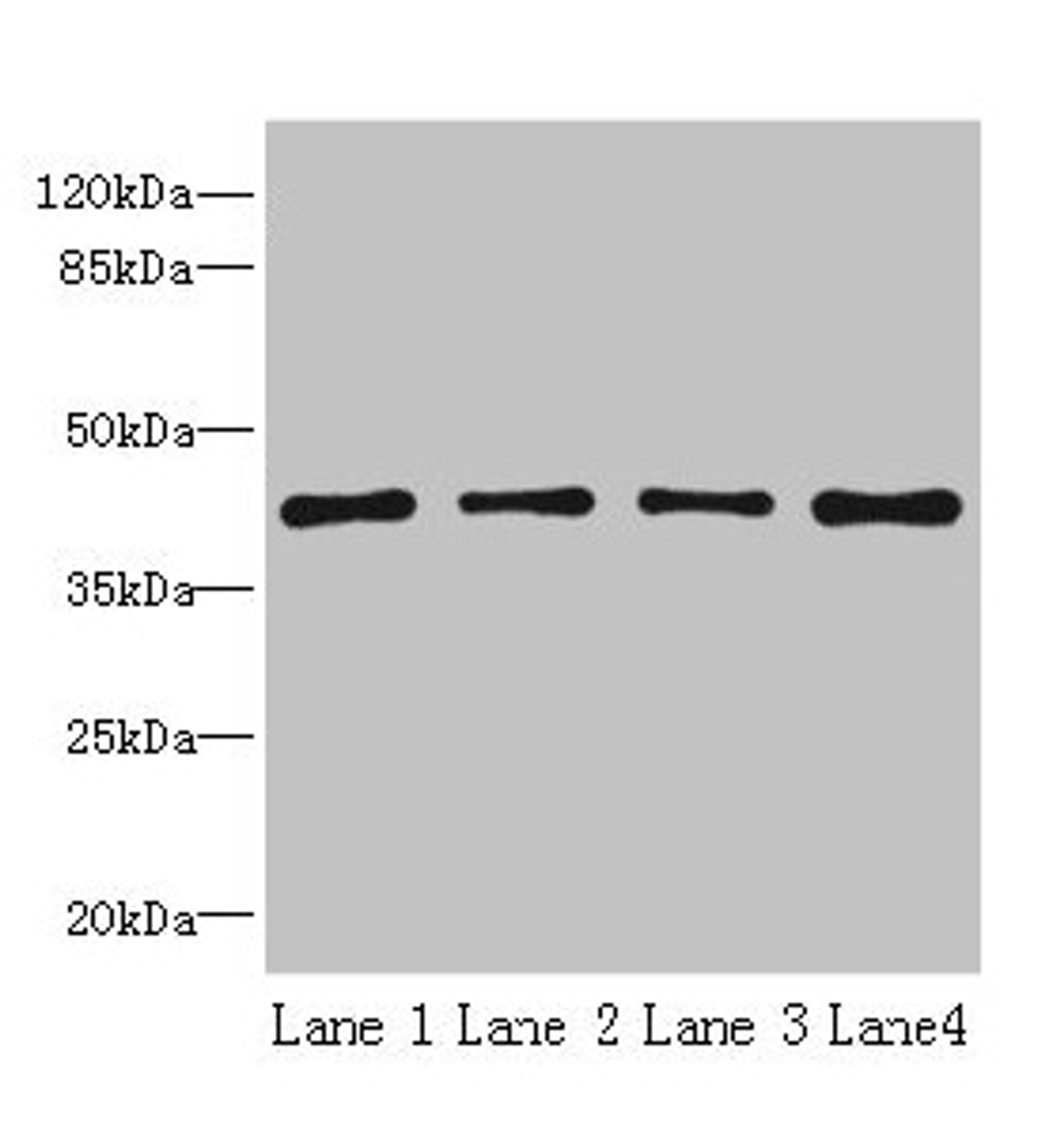 Western blot. All lanes: S1PR1 antibody at 2µg/ml. Lane 1: Jurkat whole cell lysate. Lane 2: A375 whole cell lysate. Lane 3: Mouse thymus tissue. Lane 4: HepG2 whole cell lysate. Secondary. Goat polyclonal to rabbit IgG at 1/10000 dilution. Predicted band size: 43 kDa. Observed band size: 43 kDa