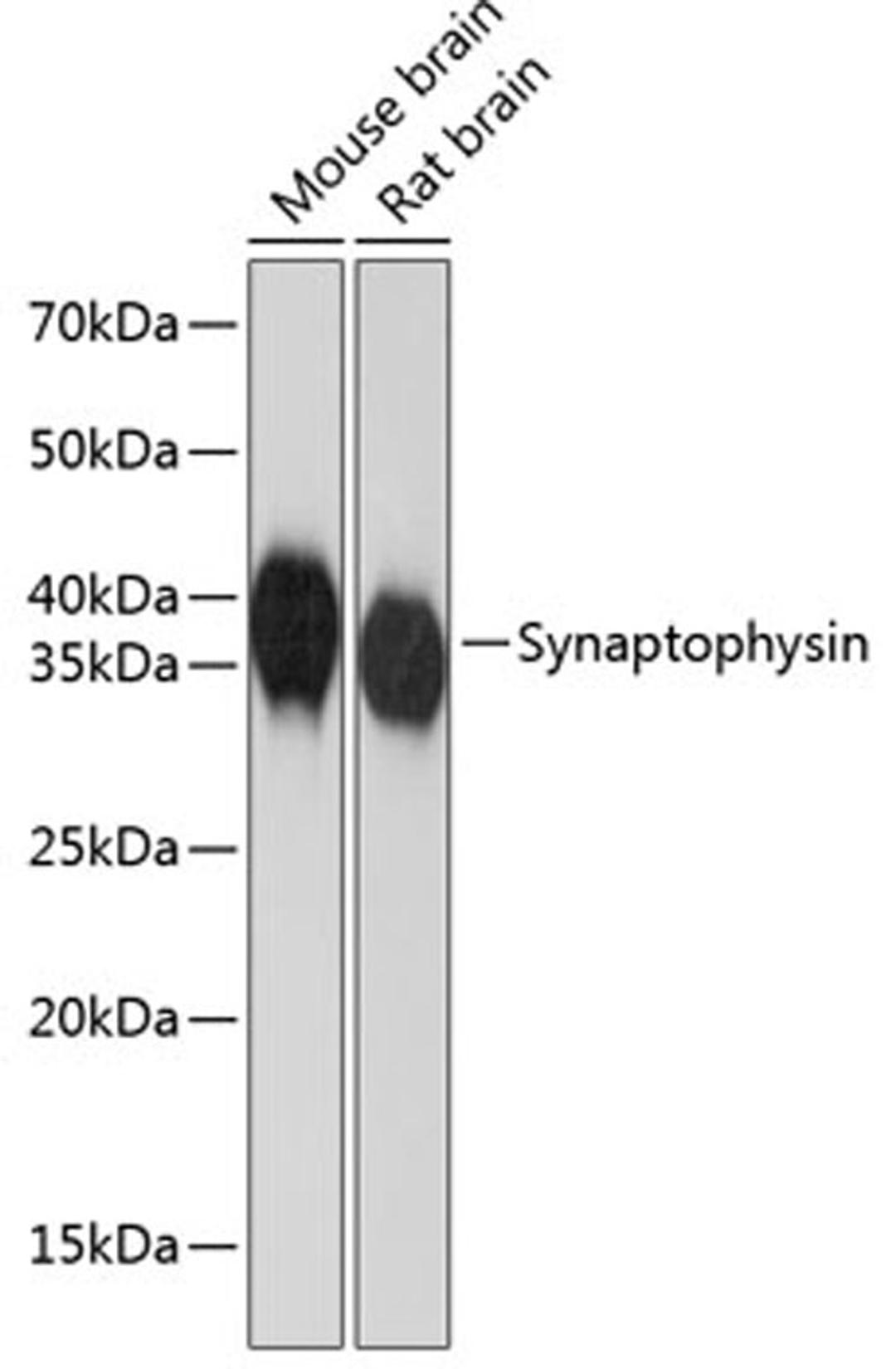 Western blot - Synaptophysin antibody (A19122)