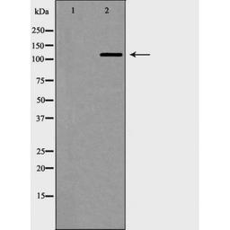 Western blot analysis of Jurkat cells using Telomerase (Phospho-Ser824) antibody